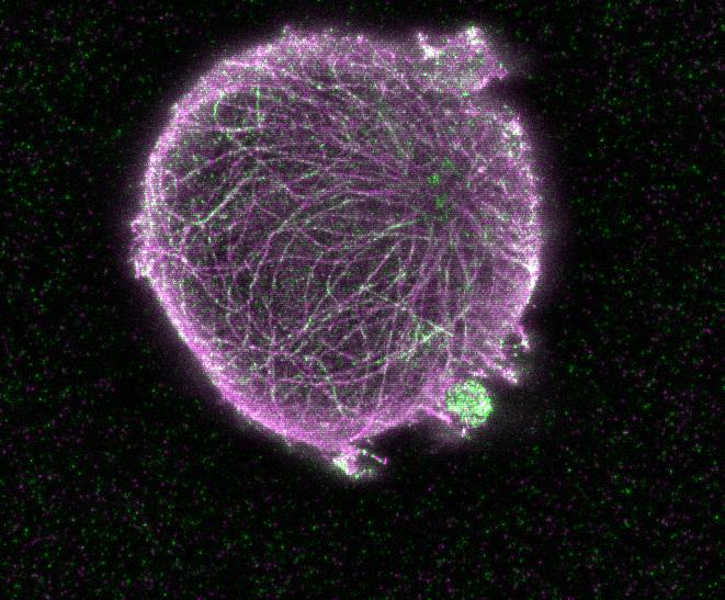 Super Resolution Microscopy